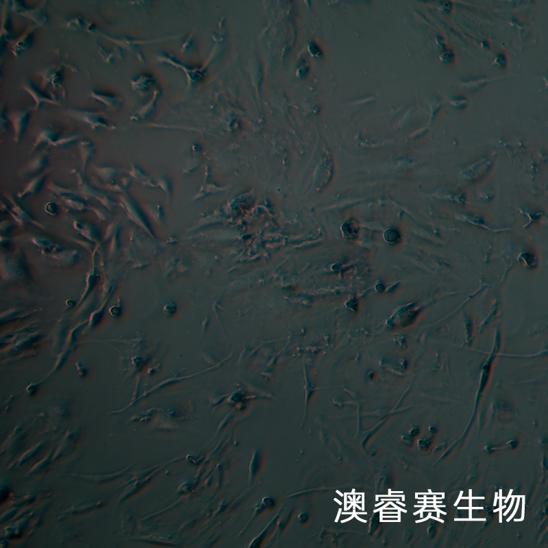 hEM15A（人永生化子宮異位內(nèi)膜上皮細(xì)胞）,hEM15A
