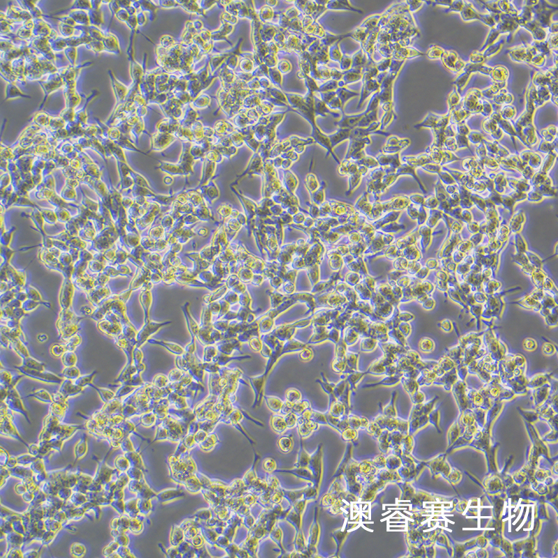 293E（人胚腎細(xì)胞）,293E