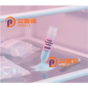 5Lipoxygenase抗体,Rabbit Monoclonal 5Lipoxygenase Antibody