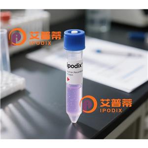 GEFH1抗体,Rabbit Monoclonal GEFH1 Antibody