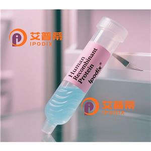 Phospho-RIP3(S232)抗体,Rabbit Monoclonal Phospho-RIP3(S232) Antibody
