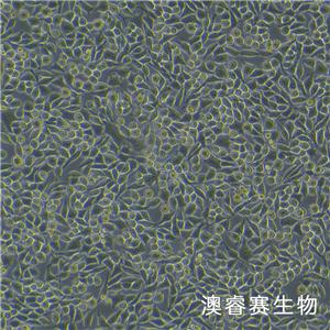 L-WRN（小鼠皮下结缔组织细胞）