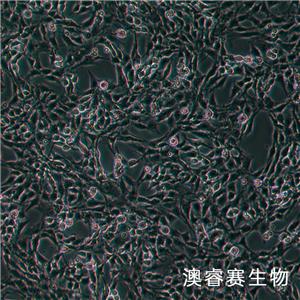CTX TNA2（大鼠星形膠質(zhì)細(xì)胞）