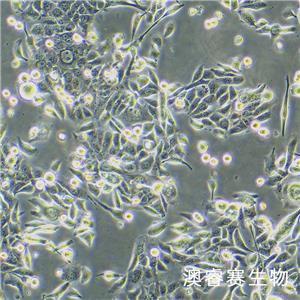 JIMT-1（人乳腺癌细胞）