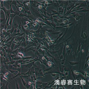 SW1783（人腦星形膠質(zhì)瘤細(xì)胞）
