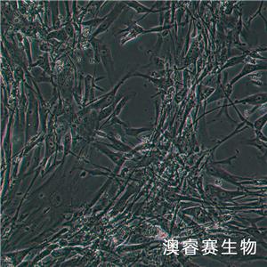 Hs888Lu（人肺成纖維細胞）