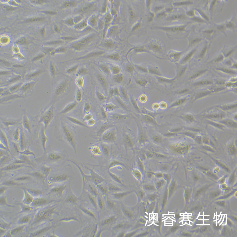 CFSC-8B（大鼠肝星形活細(xì)胞）,CFSC-8B