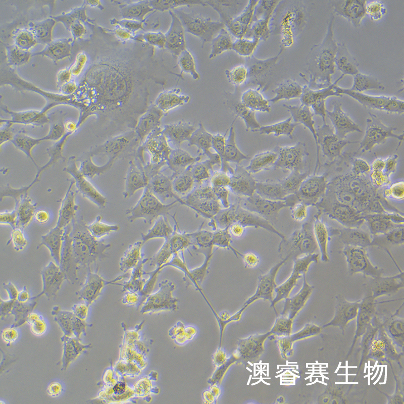 HEY A8（人卵巢癌细胞）,HEY A8