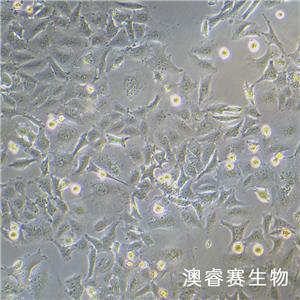 KYSE-520（人食管鱗癌細胞）,KYSE-520