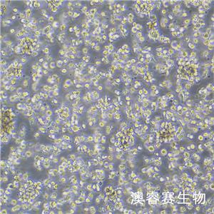 SU-DHL-1（人間變性大細(xì)胞淋巴瘤細(xì)胞）