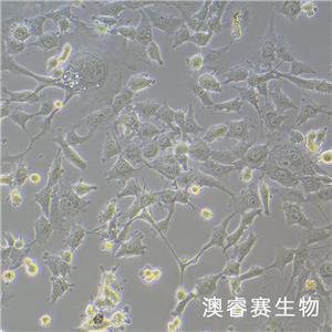 HEY A8（人卵巢癌细胞）,HEY A8