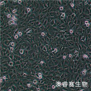 Ovcar 8（人卵巢癌腺癌细胞）