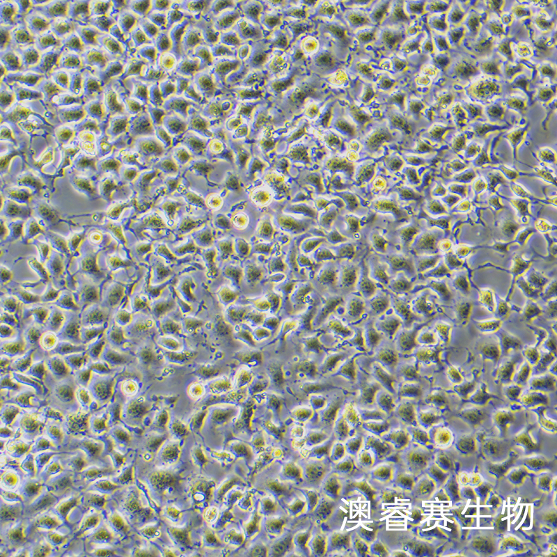 EpH4-Ev（小鼠乳腺上皮细胞）,EpH4-Ev