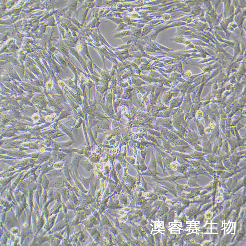 MOVAS（小鼠主动脉血管平滑肌细胞）,MOVAS