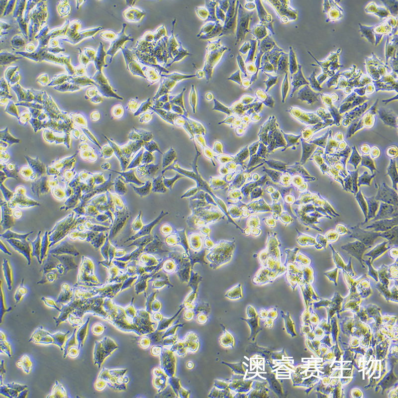 SNU398（人肝癌细胞）,SNU398