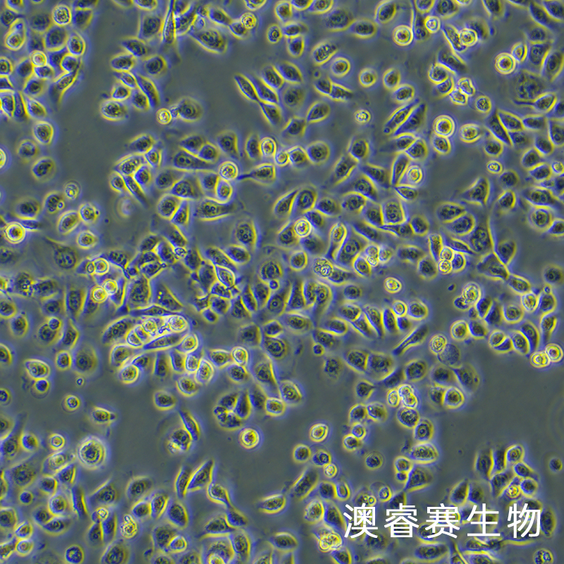 HEEC（人正常食管上皮细胞）,HEEC