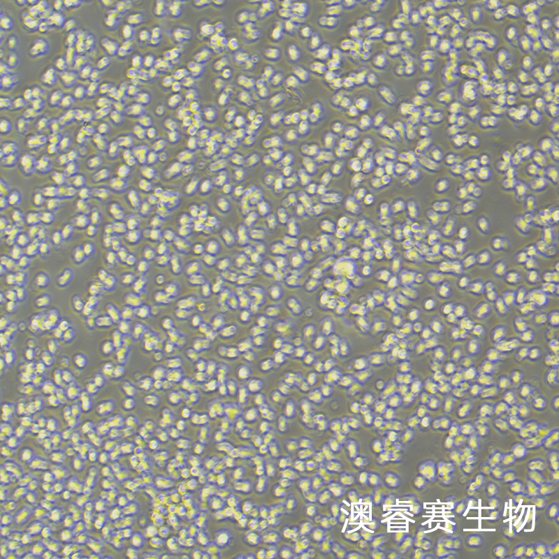 MEC-1（人慢性B细胞白血病细胞）,MEC-1