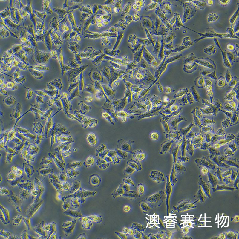 SW 756（人子宫鳞状癌细胞）,SW 756