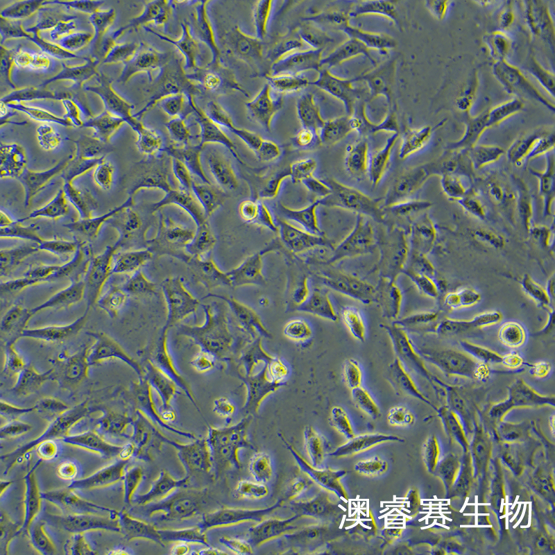 hRMECs（人视网膜微血管内皮细胞）,hRMECs