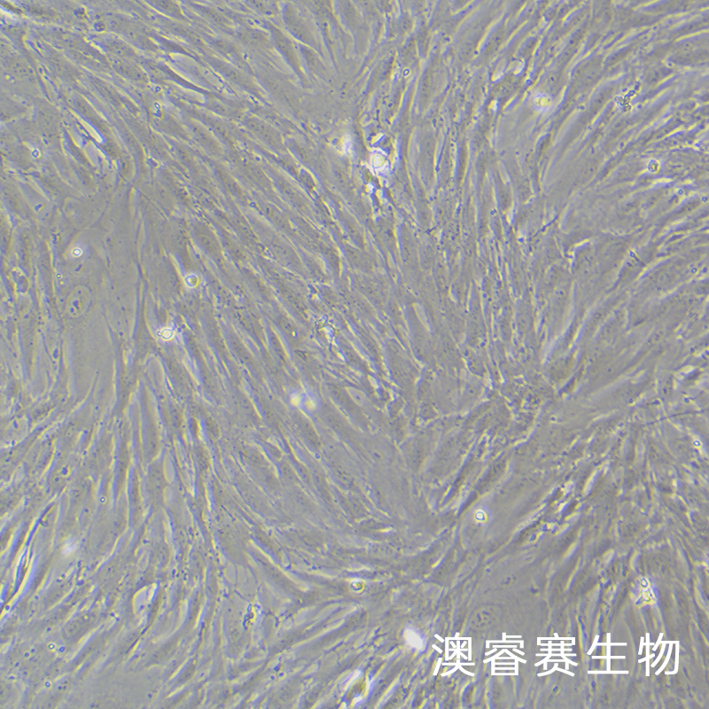 HPNE（人胰腺导管细胞）,HPNE