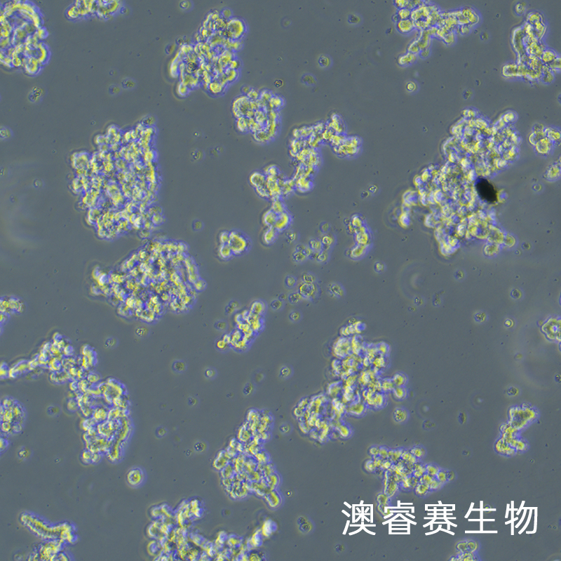 Y79（人视网膜母细胞瘤）,Y79