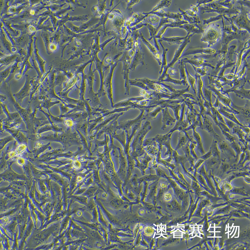 U251/GFP（人神经胶质细胞瘤细胞带绿色荧光）,U251/GFP