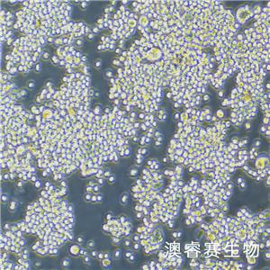 CCD-841CoN（人正常结肠上皮细胞）