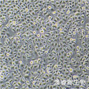 EpH4-Ev（小鼠乳腺上皮細(xì)胞）