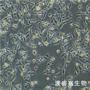 SW 756（人子宫鳞状癌细胞）,SW 756