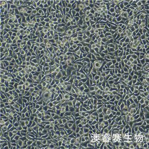 DRG（大鼠背根神經(jīng)節(jié)細胞）