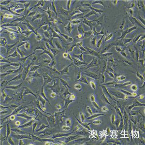 hRMECs（人视网膜微血管内皮细胞）