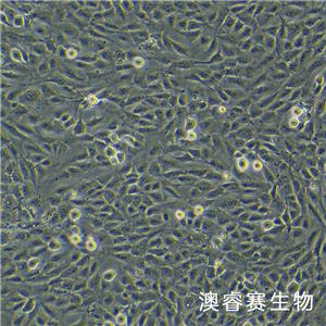 HCMEC/D3（永生化脑微血管内皮细胞）
