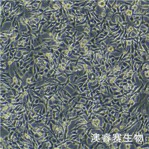 MC38（小鼠結(jié)腸癌細(xì)胞）