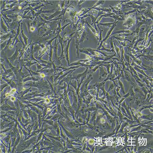 U251/GFP（人神经胶质细胞瘤细胞带绿色荧光）