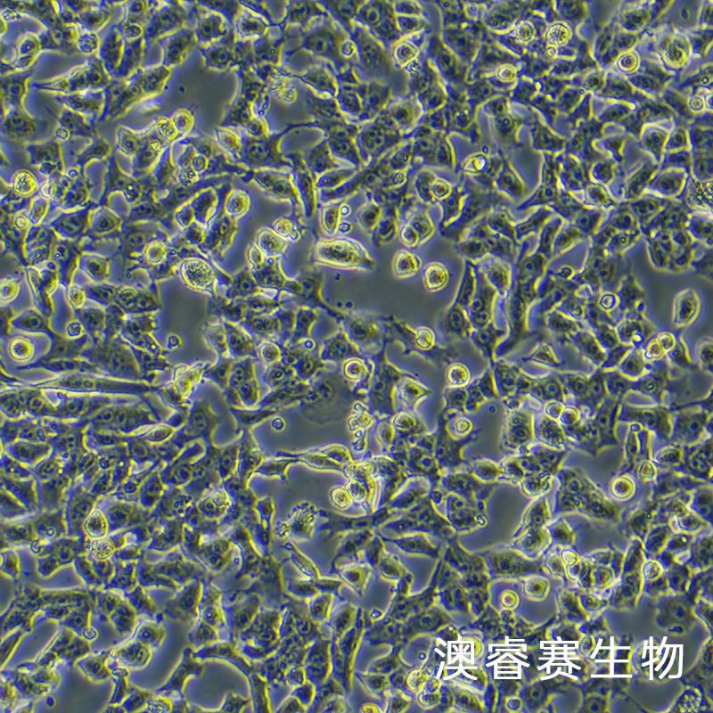 HEPA1-6-LUC（萤火虫荧光素酶标记的小鼠肝癌细胞）,HEPA1-6-LUC