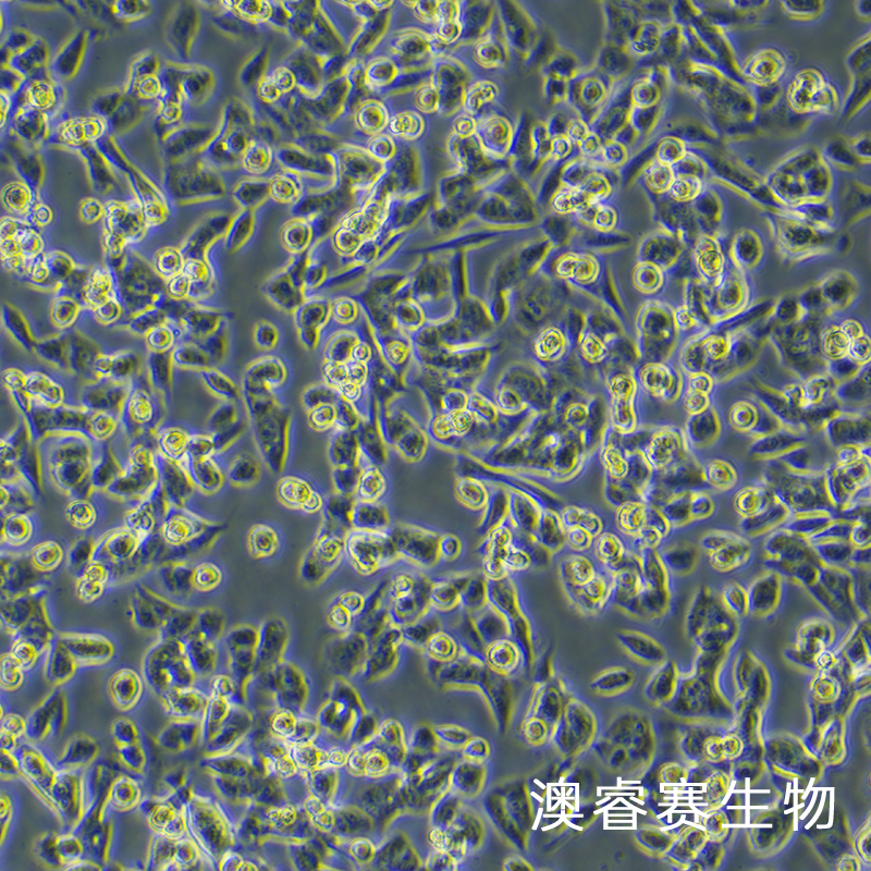 MCA-205（小鼠纤维肉瘤细胞）,MCA-205