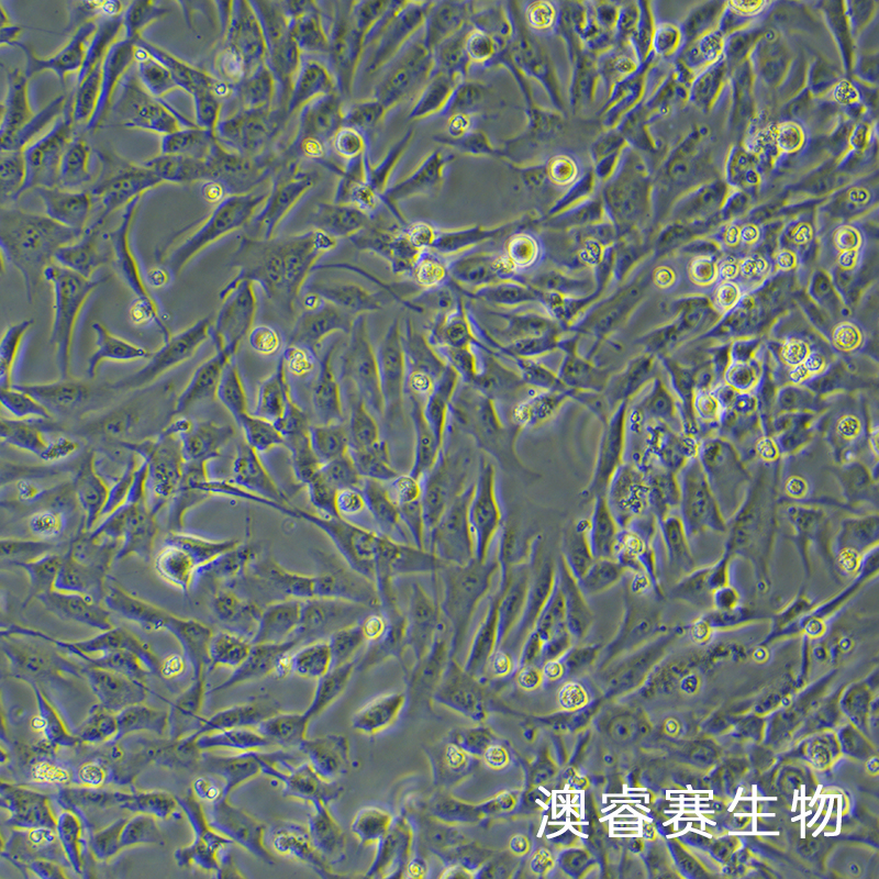 T/G HAVSMC（人血管平滑肌细胞）,T/G HAVSMC