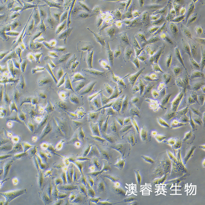 MDA-MB-231-luc（人乳腺癌细胞-荧光素酶标记）,MDA-MB-231-luc