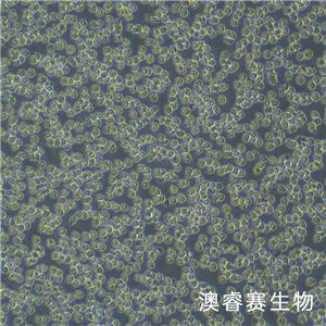 Nalm-6（人B淋巴白血病细胞）