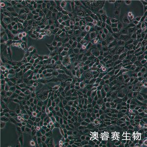 NPC/HK-1（人鼻咽癌细胞）