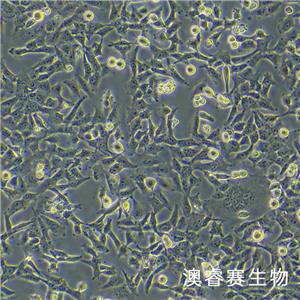 HTR-8/Svneo（人绒毛膜滋养细胞）