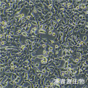 HEPA1-6-LUC（萤火虫荧光素酶标记的小鼠肝癌细胞）,HEPA1-6-LUC
