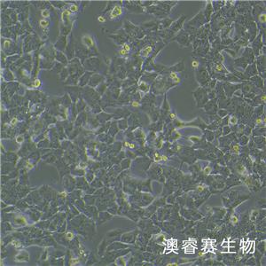 GL261-LUC（小鼠胶质瘤细胞带荧光素酶）