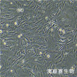 sNF96.2（人雪旺细胞神经纤维瘤病1型）