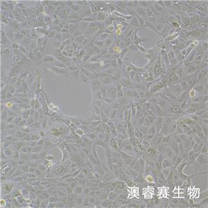 MDCK [NBL-2]（犬肾细胞）