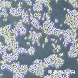 Walker/LLC-WRC 256（大鼠腹水癌细胞）