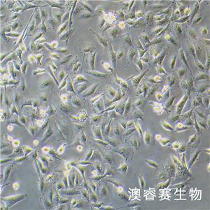 MDA-MB-231-luc（人乳腺癌细胞-荧光素酶标记）