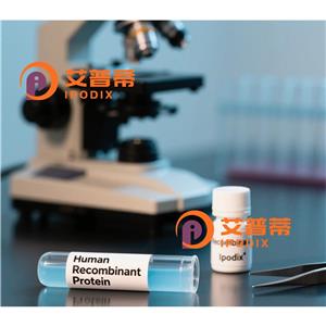 RAVER2抗体,Rabbit Monoclonal RAVER2 Antibody