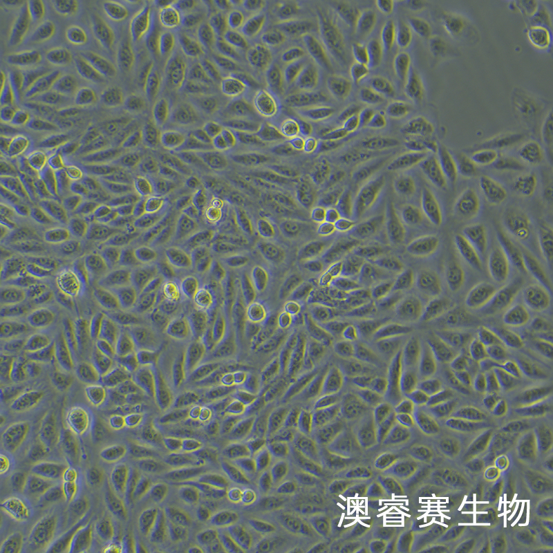 tpc-1（人甲状腺乳头状细胞）,tpc-1