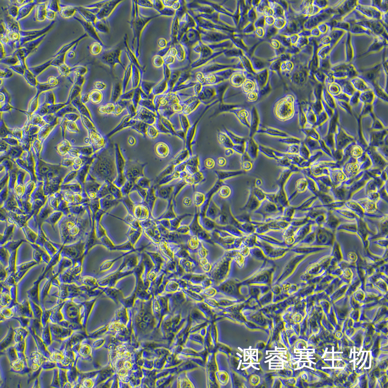 TC-1（小鼠肺上皮細(xì)胞）,TC-1
